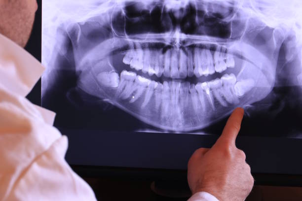 Best Emergency Dental Care for Broken or Chipped Teeth in Warrensburg, IL