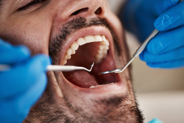 Best After-Hours Dental Trauma Care in Warrensburg, IL
