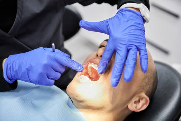 Best Emergency Gum Treatment in Warrensburg, IL