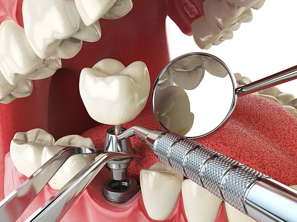 Best Emergency Orthodontic Services in Warrensburg, IL